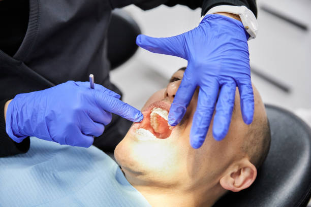 Best Emergency Tooth Extraction in Edgecliff Village, TX